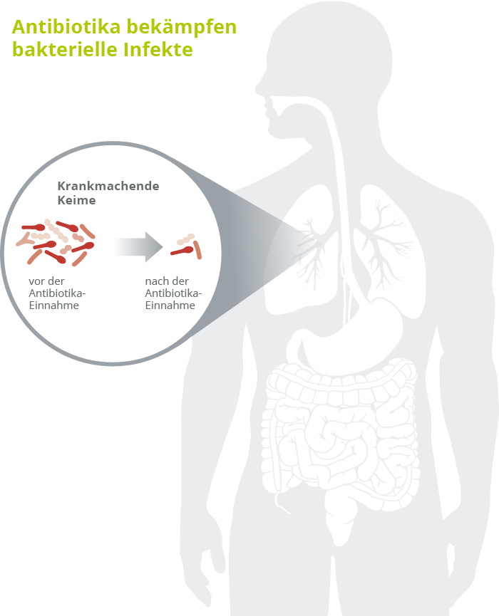 Antibiotika bek&auml;mpfen bakterielle Infekte 