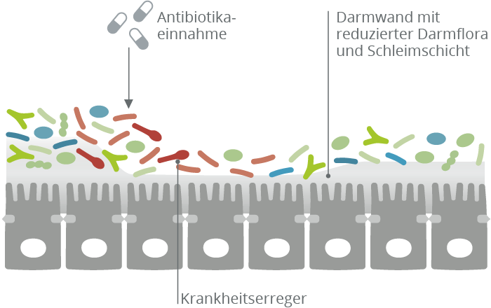 Reduzierung der gesunden Bakterienvielfalt im Darm 