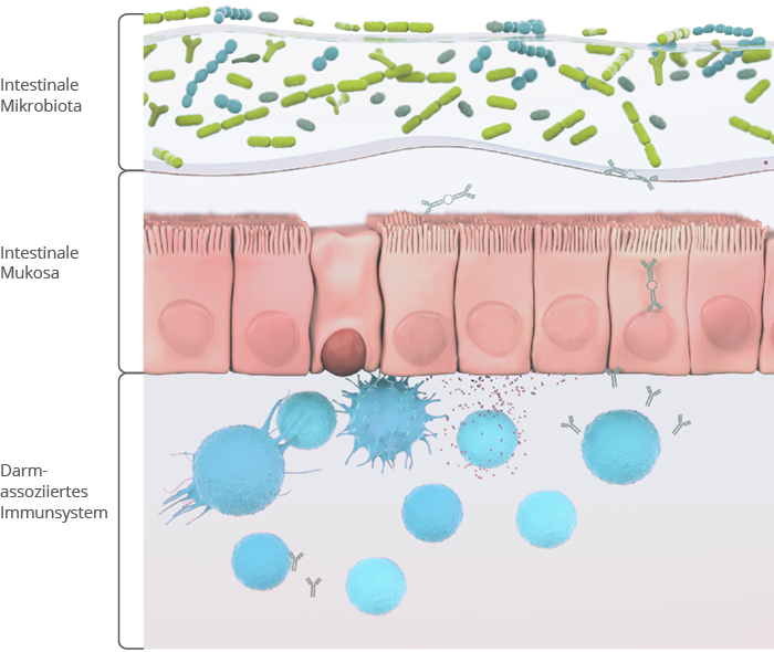 Darmflora, Darmschleimhaut, Darm-assoziiertes Immunsystem sind die 3 Schutzebenen des Darms