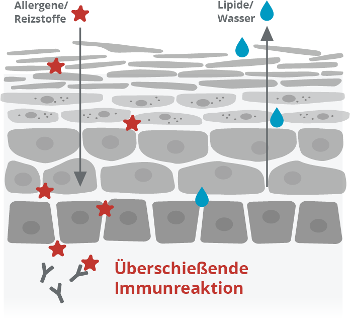 Gest&ouml;rte Hautbarriere.