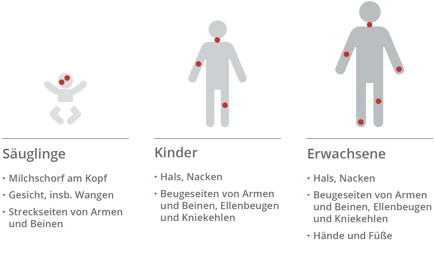 Neurodermitis: Die betroffenen Hautstellen bei S&auml;uglingen, Kindern und Erwachsenen sind unterschiedlich. 