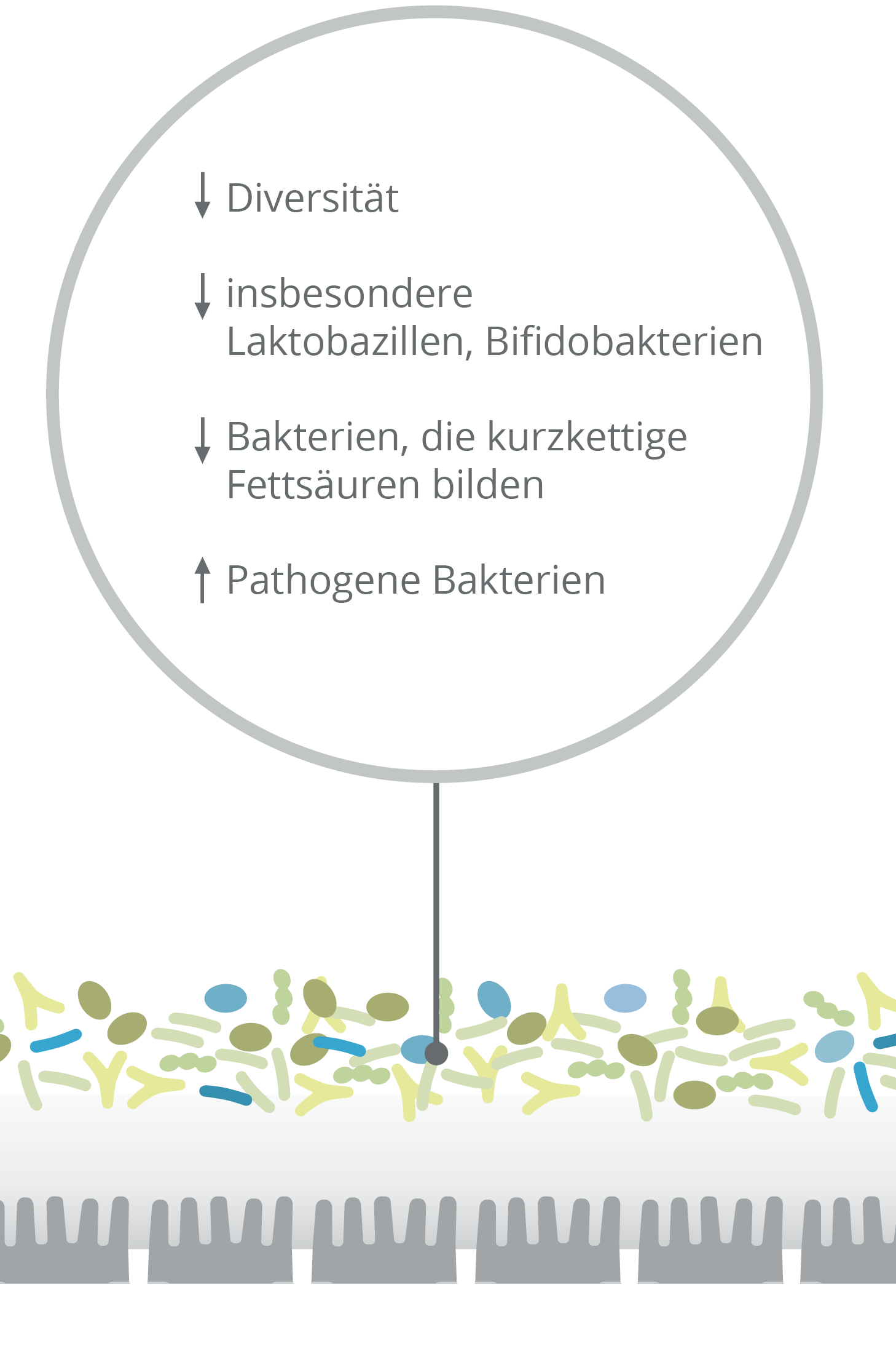 Darmflora im Ungleichgewicht bei Reizdarm