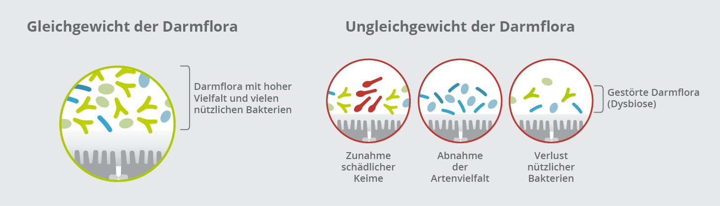 Kennzeichen einer gest&ouml;rten Darmflora
