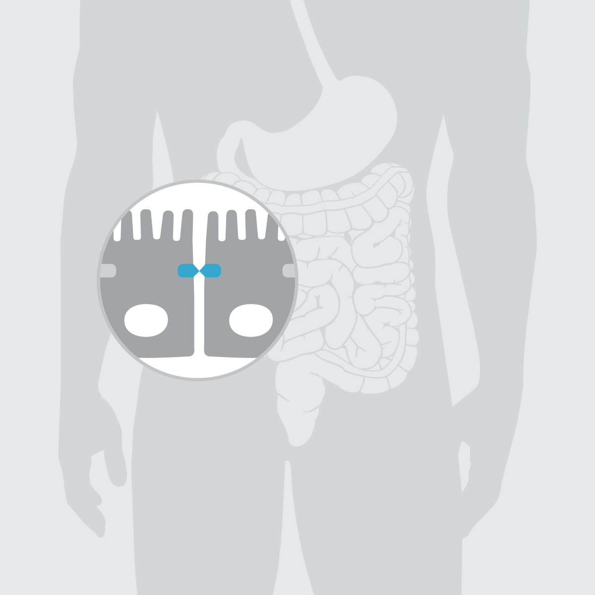 Fokus Darmschleimhaut